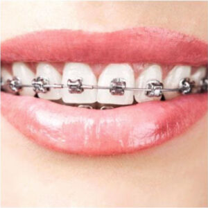 Apparecchio tradizionale